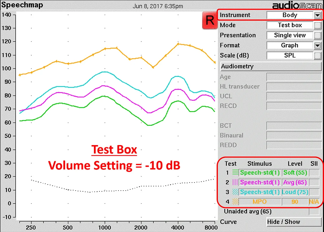 Visual for this record: The ABX test scores audibility, not preference